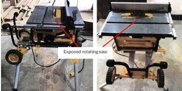 Apprentice joiner’s thumb re-attached