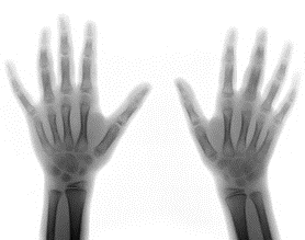 Housing corporate not noted energy device vibration chance